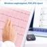 Kép 3/16 - Viatom Pulsebit - Személyi EKG